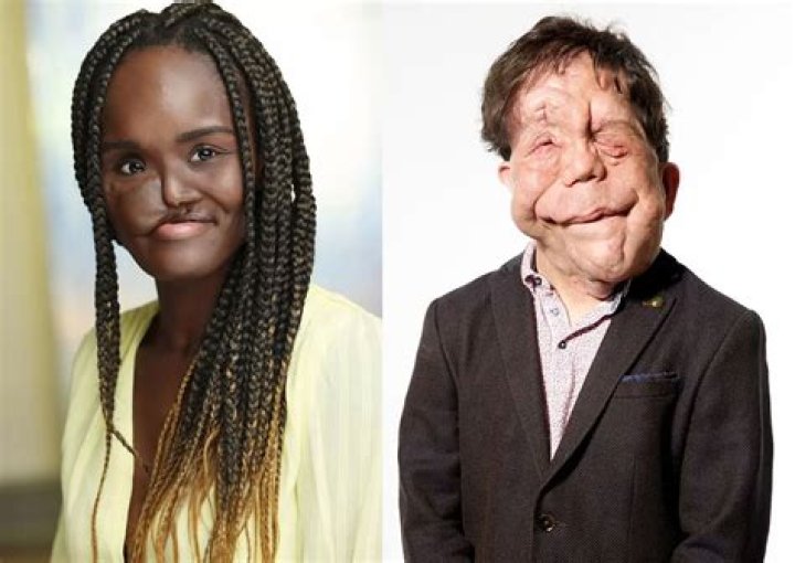 Exploring Adam Pearson's Relationships: A Journey Through Connection