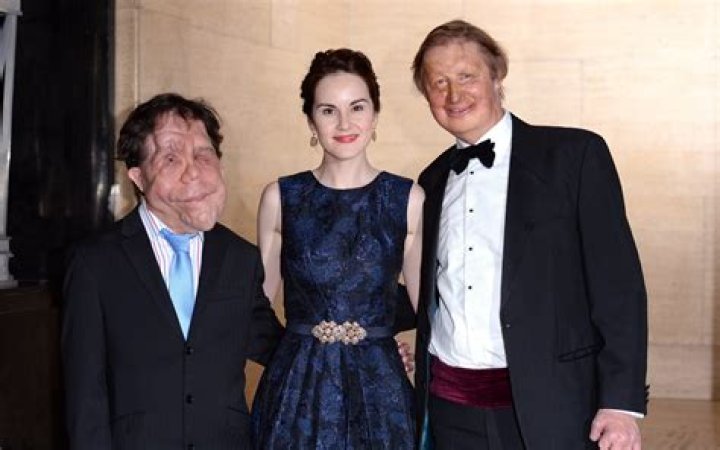 Exploring the Life and Love of Adam Pearson's Wife