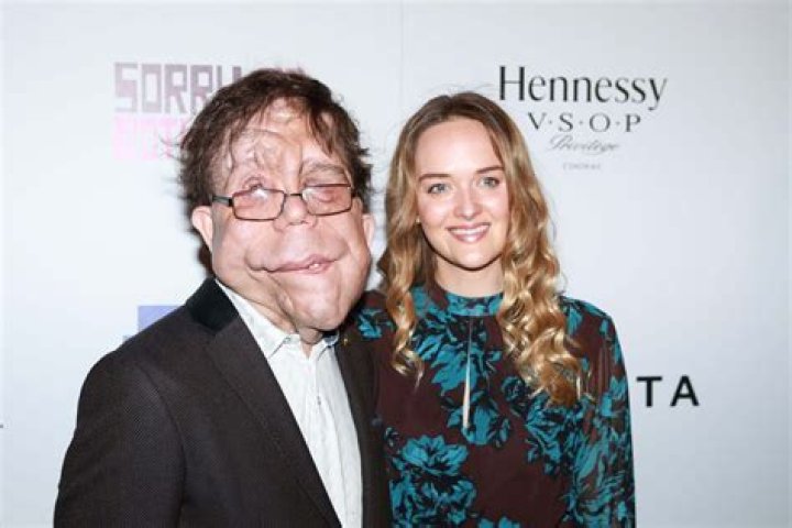 Inspiring Journey of Adam Pearson: Overcoming Challenges and Embracing Life