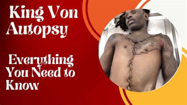 King Von Autopsy Photos: Shocking Details Revealed
