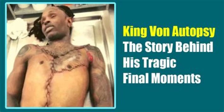 King Von Autopsy: Unraveling the Mystery Behind His Untimely Death
