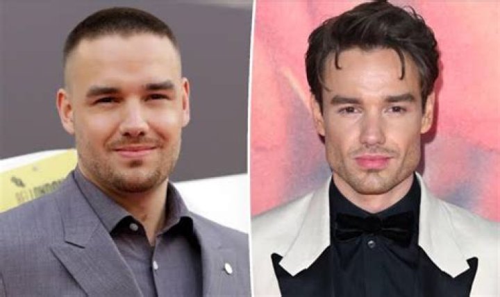Liam Payne Before and After: A Surprising Transformation!
