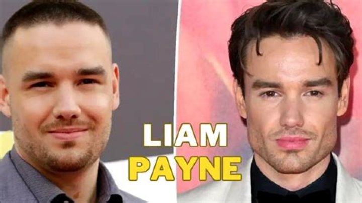 Liam Payne Nose Job: Before and After Transformation Revealed