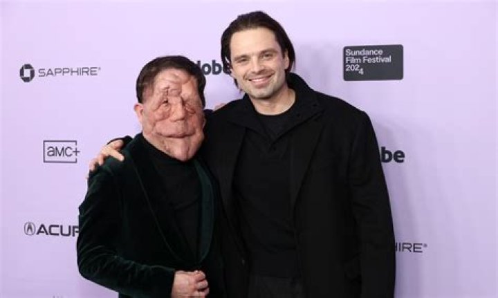 Love Story: Adam Pearson and His Dedicated Wife
