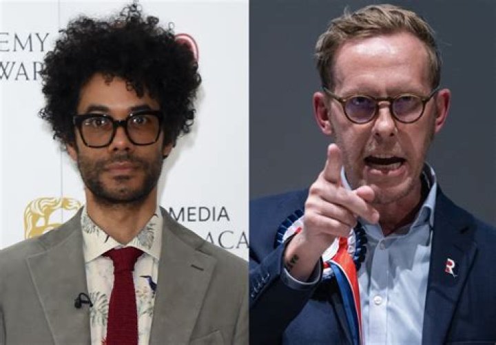 Shocking Truth About Richard Ayoade's Horrific Accident Revealed