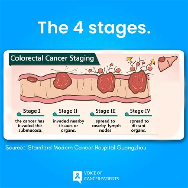 The Courageous Journey of the Pioneer Woman: Battling Stage 4 Colon Cancer