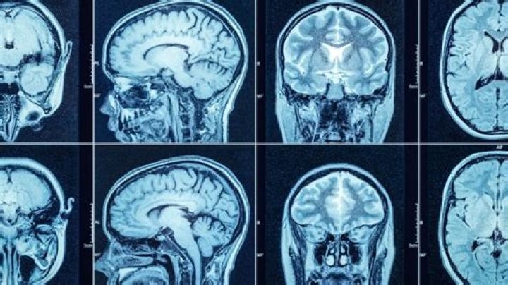 The Tragic Life and Career of Johnny Lewis: A Hollywood Heartbreak