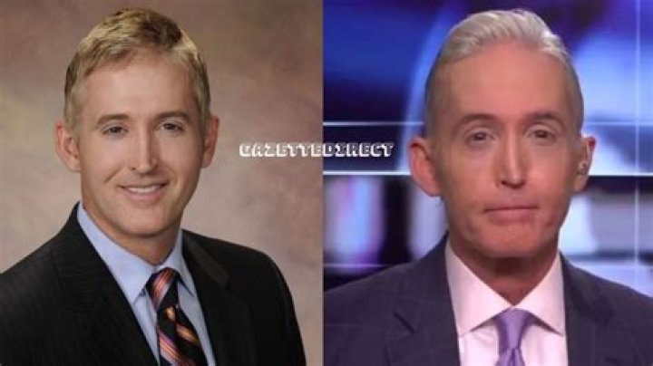 Trey Gowdy's Nose Transformation: Before and After