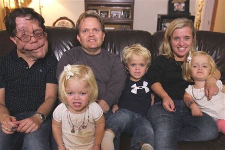 Understanding the Life and Partner of Adam Pearson