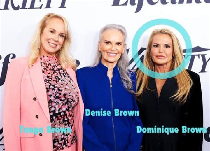 Unraveling the Mystery of the Dominique Brown Face Accident